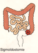 sigmoid