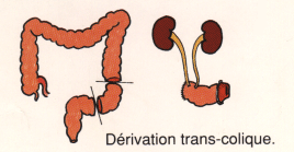 deritranscol