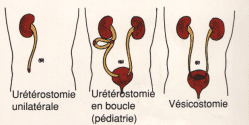 unilatvesi